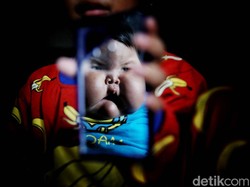Menkes Minta Biaya Pengobatan Bayi Obesitas di Bekasi Ditanggung BPJS