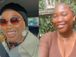 Curhat Wanita Risih Punya Payudara Ukuran 34KK, Sering Bikin Nyeri