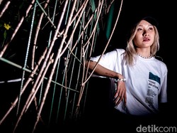 Dihujat hingga Drop, Sallsa Bintan Beri Penjelasan Soal Masalah Rambut Botak