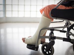 Pengertian Gips: Manfaat, Jenis, Proses Pemasangan, dan Perawatan Gips