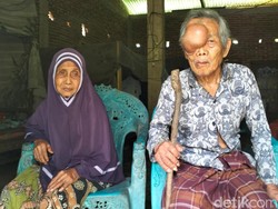 Tolong! Lansia Miskin di Polman Derita Benjolan Besar di Wajahnya