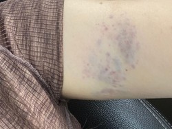 Kasus KDRT Sepupu Calon Istri Fritz Hutapea Ditangani Polres Mojokerto Kota