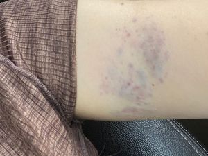 Kasus KDRT Sepupu Calon Istri Fritz Hutapea Ditangani Polres Mojokerto Kota Kasus KDRT Sepupu Calon Istri Fritz Hutapea Ditangani Polres Mojokerto Kota