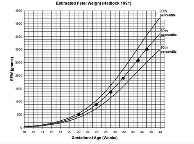 Grafik Pertumbuhan Janin (Hadlock 1991) / Grafik: ResearchGate