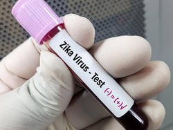 AS Keluarkan Travel Warning Virus Zika di Bali, Dinkes Pastikan Belum Ada Kasus