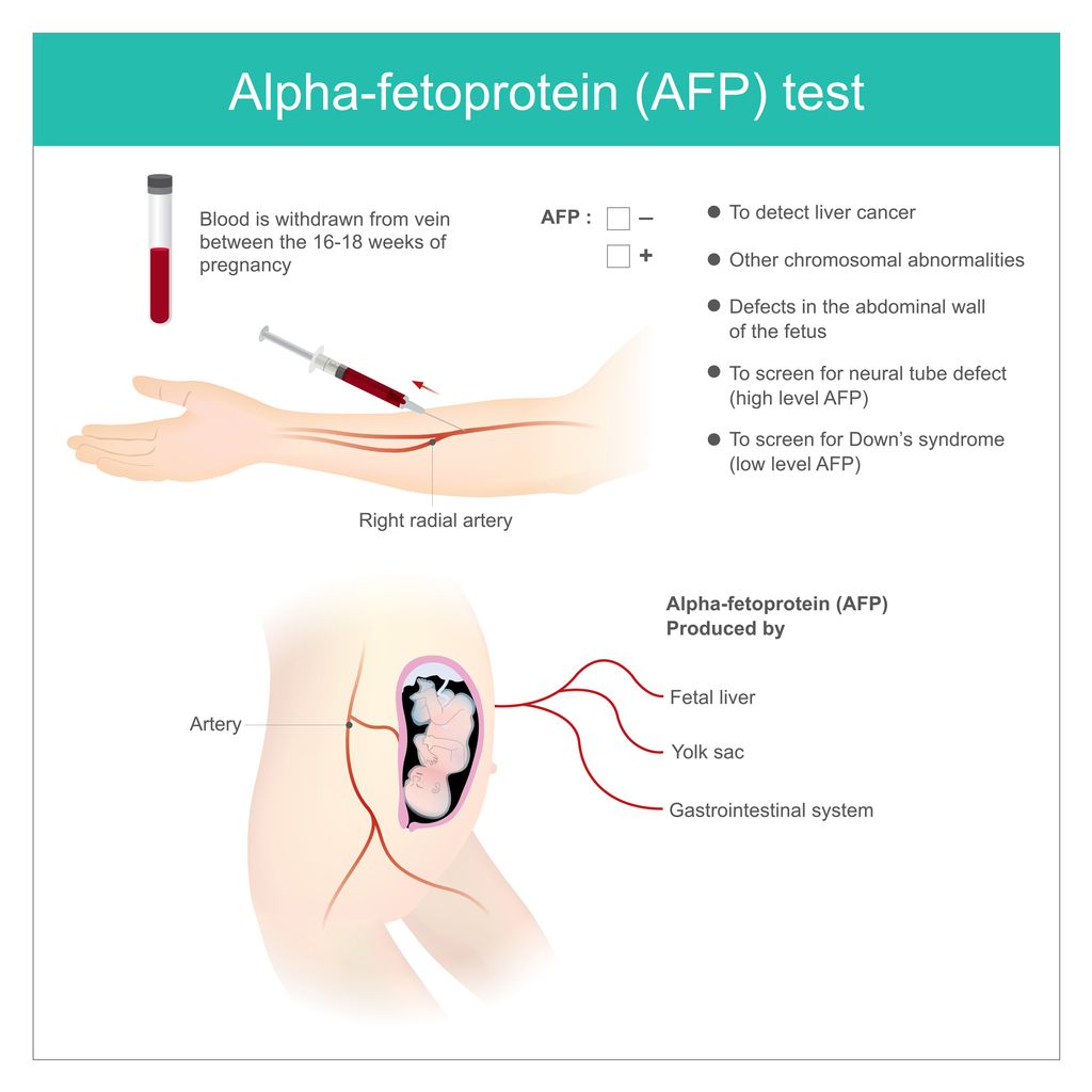 Ilustrasi tes alpha fetoprotein (AFP)
