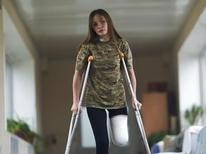 Potret Tentara Wanita Ukraina Kehilangan Satu Kaki Saat Lawan Rusia Potret Tentara Wanita Ukraina Kehilangan Satu Kaki Saat Lawan Rusia