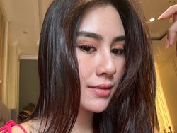 Ramai Diduga Oplas, Begini Tanggapan Syahnaz Sadiqah, Faktanya Diungkap Kakak