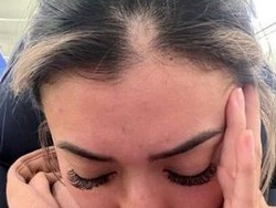 Influencer yang Dipenjara di Dubai Ungkap Kondisinya, Kepalanya Jadi Pitak