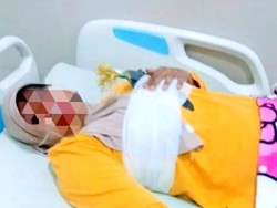 Ngeri! Wanita di Gowa Kena Busur di Payudara Saat Naik Motor