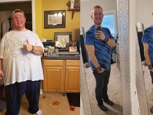 Before-After Casey King, Pria yang Sukses Pangkas BB hingga 272 kg