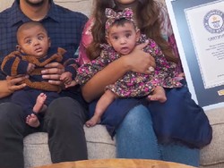 Bayi Kembar Paling Prematur di Dunia, Lahir Saat Usia Kandungan 22 Minggu