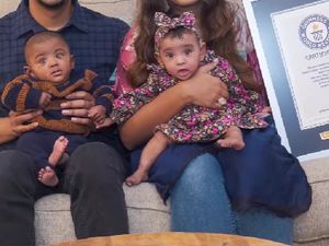 Bayi Kembar Paling Prematur di Dunia, Lahir Saat Usia Kandungan 22 Minggu Bayi Kembar Paling Prematur di Dunia, Lahir Saat Usia Kandungan 22 Minggu