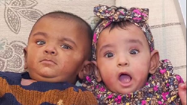 8 Foto Bayi Kembar Paling Prematur di dunia, Rayakan Ulang Tahun yang Pertama