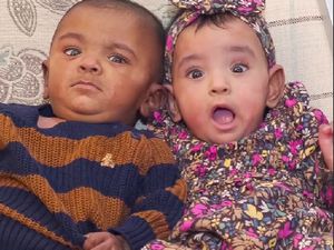 8 Foto Bayi Kembar Paling Prematur di dunia, Rayakan Ulang Tahun yang Pertama 8 Foto Bayi Kembar Paling Prematur di dunia, Rayakan Ulang Tahun yang Pertama