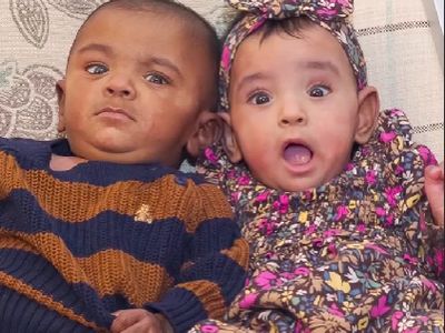 8 Foto Bayi Kembar Paling Prematur di dunia, Rayakan Ulang Tahun yang Pertama