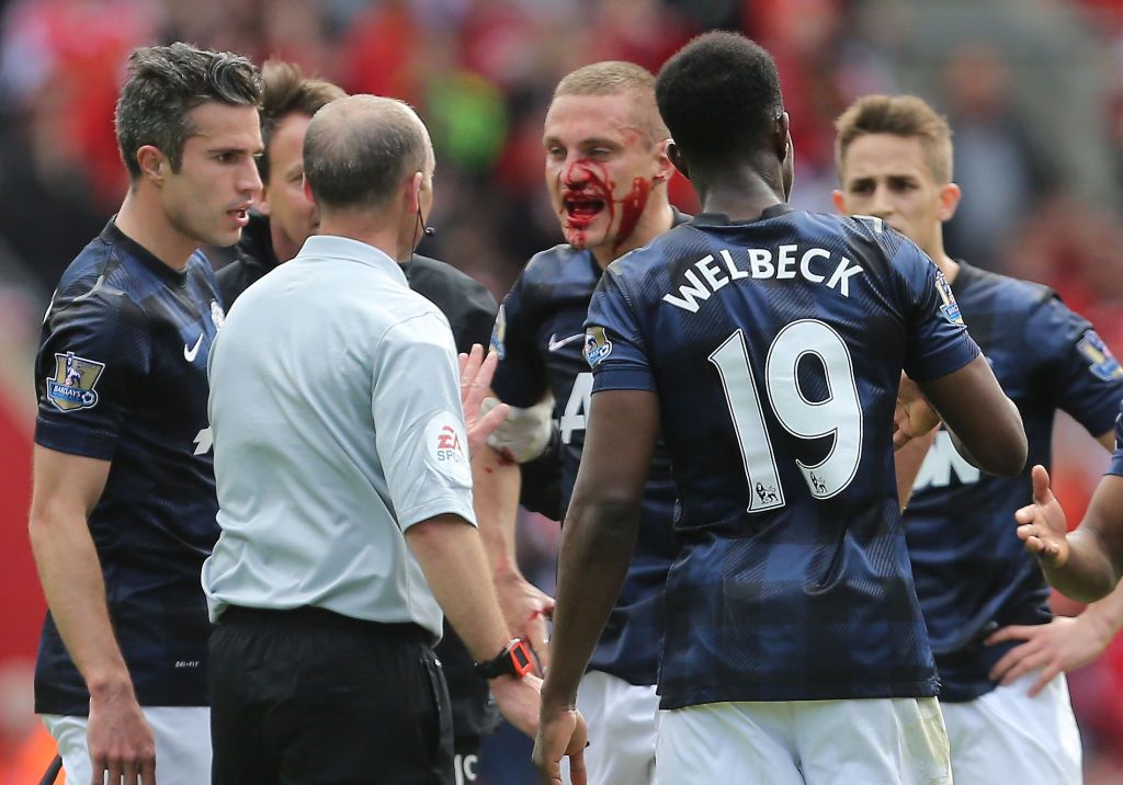 Nemanja Vidic of Manchester United with a bloody face appeals to Referee Mike Dean after Rickie Lambert of Southampton scores a goal to make it 1-0 whilst Vidic lay injured (Photo by Catherine Ivill/AMA/AMA/Corbis via Getty Images)