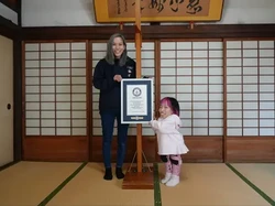 Kisah Saudara Kembar yang Punya Tinggi Badan Beda Jauh, Ternyata Idap Kondisi Ini