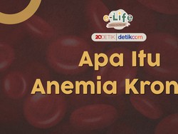 Wanita Lebih Rentan Terkena Anemia