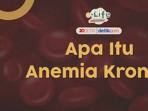 Wanita Lebih Rentan Terkena Anemia Wanita Lebih Rentan Terkena Anemia