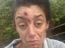 Penampakan Dulu & Sekarang Wanita yang Viral Pernah Overdosis Narkoba 5 Kali