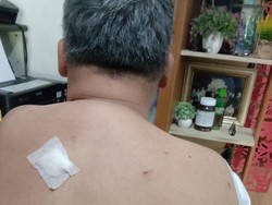 Dibegal di Bogor, Pengurus PSI Jabar Terkena 10 Sabetan Celurit