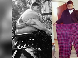 Terapkan Pola Makan Defisit Kalori, Pria Ini Berhasil Turun BB 165 Kg