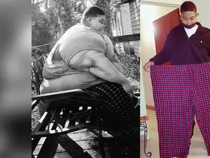 Terapkan Pola Makan Defisit Kalori, Pria Ini Berhasil Turun BB 165 Kg Terapkan Pola Makan Defisit Kalori, Pria Ini Berhasil Turun BB 165 Kg