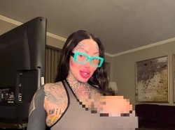 Penampakan Model Setelah Payudaranya Meledak Sebelah, Implannya Dibuang 9 Kg