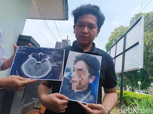 Kasus Mahasiswa UISU Dianiaya Anak Kasat Narkoba Naik ke Penyidikan Kasus Mahasiswa UISU Dianiaya Anak Kasat Narkoba Naik ke Penyidikan