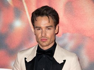 Foto: Pipi Liam Payne Makin Tirus, Diduga Suntik Filler dan Sedot Lemak Foto: Pipi Liam Payne Makin Tirus, Diduga Suntik Filler dan Sedot Lemak