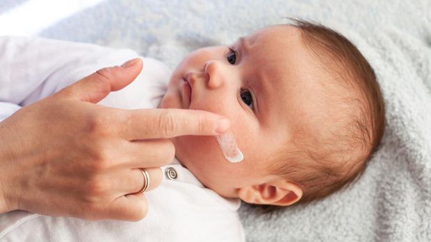 Baby with atopic dermatitis getting cream put. Care and Prevention Of Eczema. Keep Your Baby From Itching