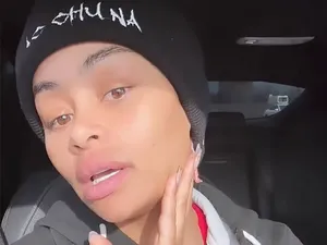 Alasan Chyna Copot Filler & Implan Bokong, Ingin Kembali ke Agama