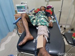 Hindari Tawuran, Pemuda di Bandar Lampung Tertembak Peluru Nyasar