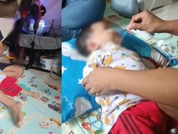 Viral Bayi Korban Gagal Ginjal Dipaksa Pulang dari RSCM, Kemenkes RI Buka Suara