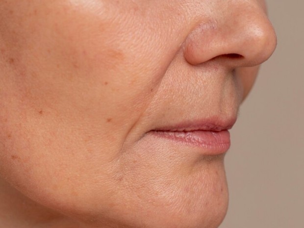 Potret kulit mengendur/ Foto: freepik.com Potret kulit mengendur