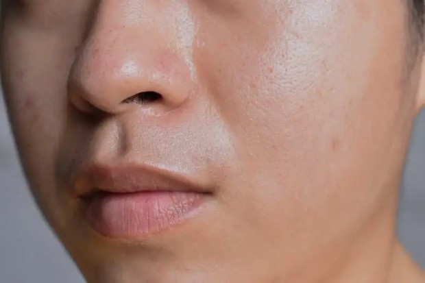 5 tanda-tanda kulit wajah kamu mengalami dehidrasi