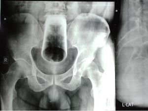 6 Potret X-Ray Mencengangkan, Tunjukkan Benda yang Nyangkut di Tubuh Pasien 6 Potret X-Ray Mencengangkan, Tunjukkan Benda yang Nyangkut di Tubuh Pasien