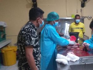 Hasil Autopsi Mayat Bayi dengan Ari-ari: Tulang-tulang Kepala Terhimpit