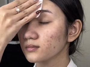 Viral Wanita Berjerawat Dirias ala Pengantin China, Hasilnya bak Ariel Tatum