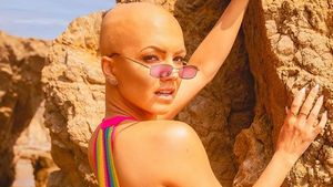 Foto: Penampilan Model Botak, Dulu Malu Kini Bersyukur