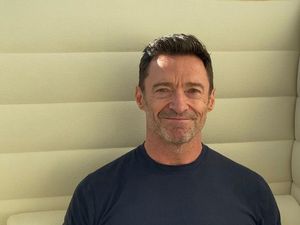 Hugh Jackman Curhat Alami Gejala Mirip Kanker Kulit, Begini Kondisinya Hugh Jackman Curhat Alami Gejala Mirip Kanker Kulit, Begini Kondisinya