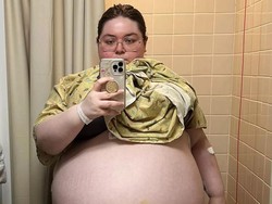 Wanita 20 Tahun Punya Kista Seberat 47 Kg Bersarang di Perut, Bikin Dokter Syok