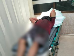 Penjual HP Korban Pembacokan di Pasuruan Kritis, Dirujuk ke RSU dr Soetomo