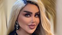 7 Foto Wanita Irak 43 Kali Operasi Plastik Demi Jadi Barbie di Dunia Nyata