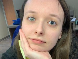 Berbagai Keanehan Fisik yang Bikin Orang-orang Ini Istimewa