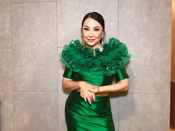 Nggak Heran Capai Ratusan Juta, Wajah Baru Titi DJ Pasca Oplas Sepangling Ini