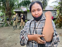 270 KK di Asahan Terdampak Wabah Ulat Bulu, Warga Gatal-gatal