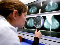 Obat Universal Kanker Mungkin Tidak Akan Ditemukan, Ini Sebabnya