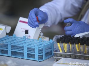 Waspadai Bahan Pangan Berbahaya, Ada Mi Kuning hingga Cone Es Krim